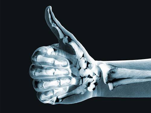 Кости напечатают на 3D-принтере