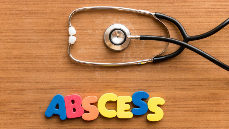 абсцесс